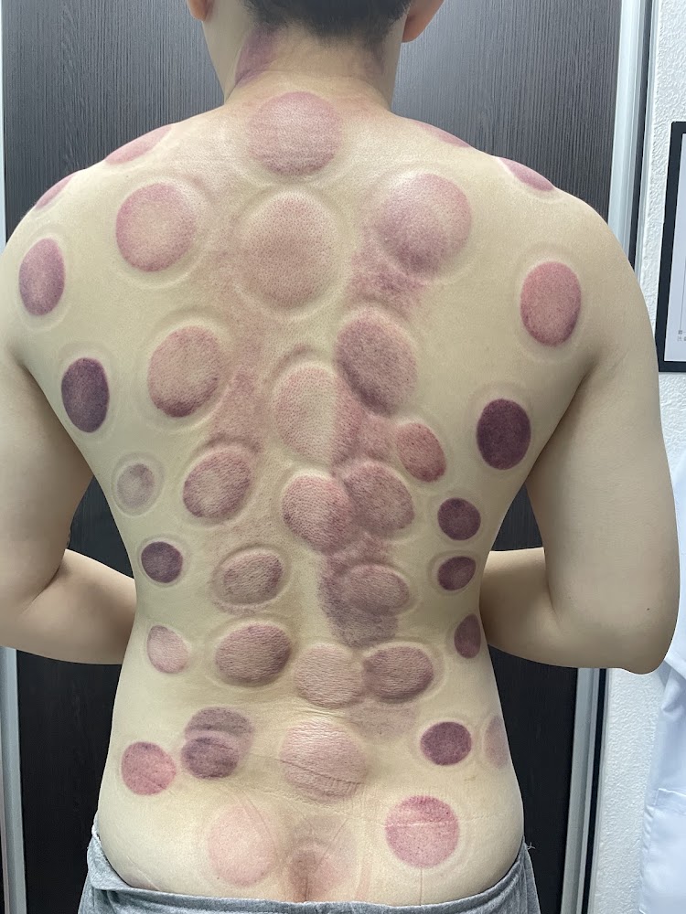 TCM Massage Therapy Center 中医理疗养生馆